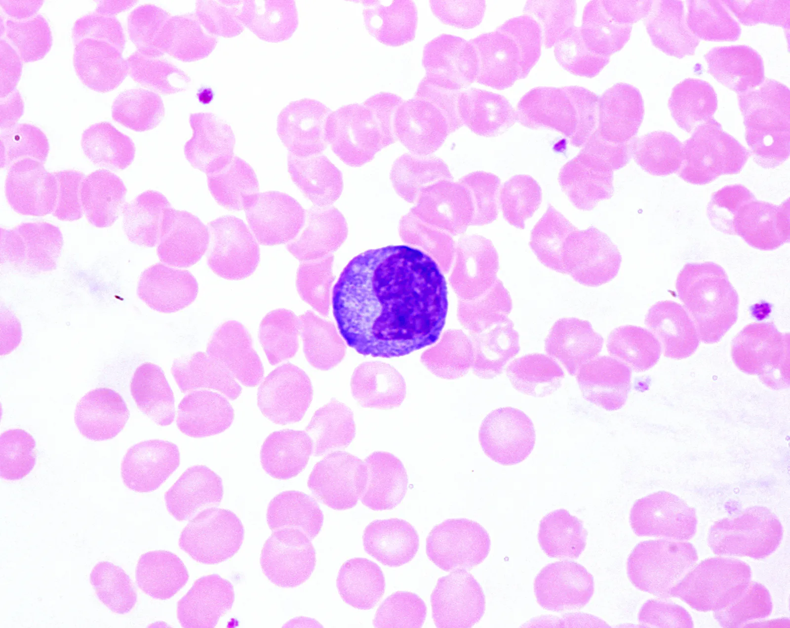 How Your Immune System Learns Germs