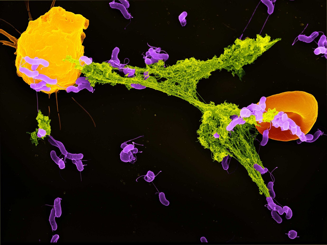 A close-up image of a neutrophil white blood cell in contact with multiple bacterial cells during an immune response
