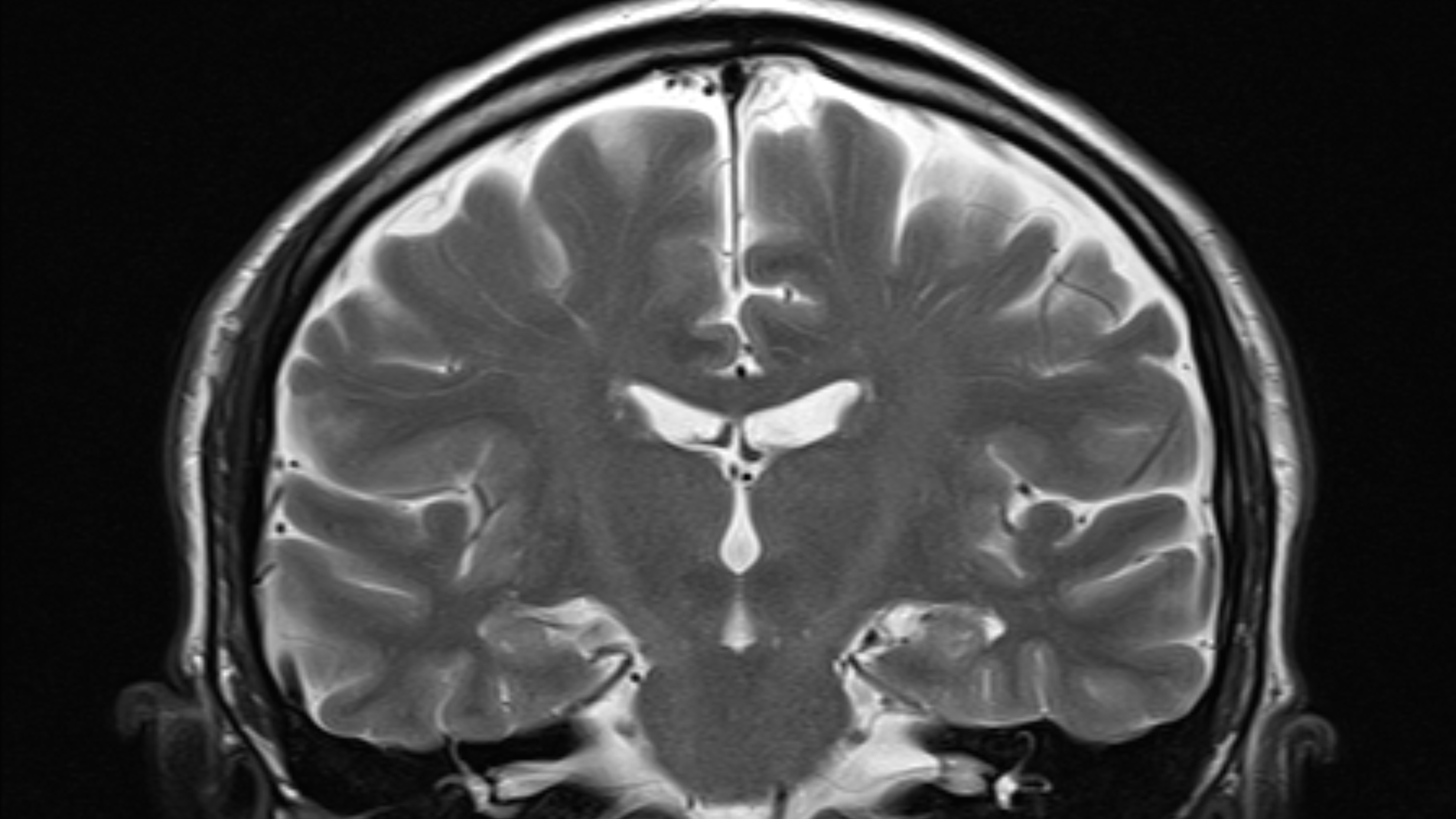 How Memory Works in the Brain